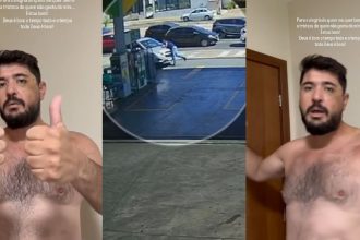 assistente-juridico-atropelado-por-advogado-tres-vezes-posta-video-mostrando-ferimentos-e-diz-nao-saber-motivo-do-crime