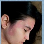 gerente-fica-com-manchas-na-pele-e-olhos-inchados-apos-nadar-no-lago-de-palmas-e-descobre-‘alergia-a-agua’