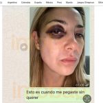 ex-primeira-dama-argentina-revela-detalhes-de-agressoes-e-reitera-acusacoes-contra-alberto-fernandez