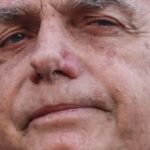 bolsonaro-apresenta-piora-clinica-e-vai-passar-por-novos-exames