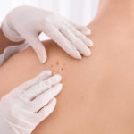 fernanda-rodrigues-e-diagnosticada-com-cancer-de-pele-pela-segunda-vez