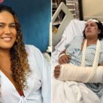 mulher-faz-cirurgia-de-reconstrucao-no-rosto-apos-ser-espancada-a-pauladas;-ex-marido-e-suspeito,-diz-pm