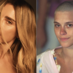 simbolo-da-beleza,-carolina-dieckmmann-conta-que-se-descobriu-bonita-apos-ficar-careca:-‘comecei-a-ver-minha-cara-limpa’