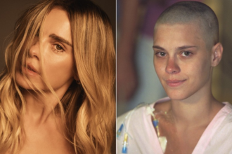 simbolo-da-beleza,-carolina-dieckmmann-conta-que-se-descobriu-bonita-apos-ficar-careca:-‘comecei-a-ver-minha-cara-limpa’