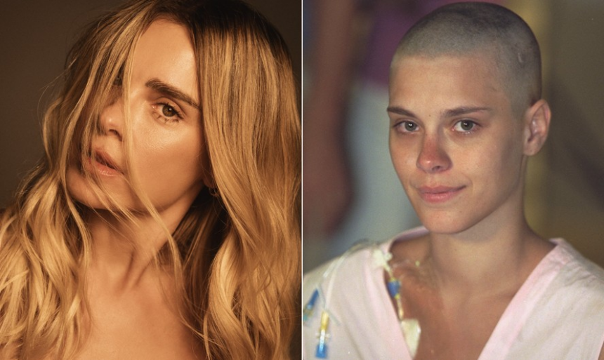 simbolo-da-beleza,-carolina-dieckmmann-conta-que-se-descobriu-bonita-apos-ficar-careca:-‘comecei-a-ver-minha-cara-limpa’