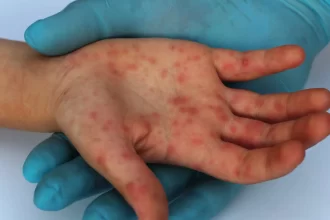 marilia-(sp)-investiga-morte-de-bebe-por-suspeita-de-sarampo