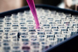 pesquisas-brasileiras-avancam-no-diagnostico-de-alzheimer