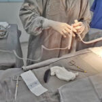 hospital-e-maternidade-dona-regina-realiza-o-primeiro-curativo-a-vacuo