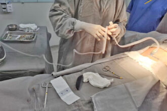 hospital-e-maternidade-dona-regina-realiza-o-primeiro-curativo-a-vacuo