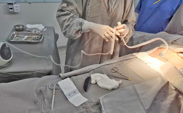 hospital-e-maternidade-dona-regina-realiza-o-primeiro-curativo-a-vacuo