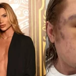 influenciador-junior-dutra-morre-apos-procedimento-estetico-malsucedido