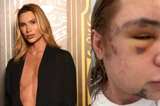 influenciador-junior-dutra-morre-apos-procedimento-estetico-malsucedido