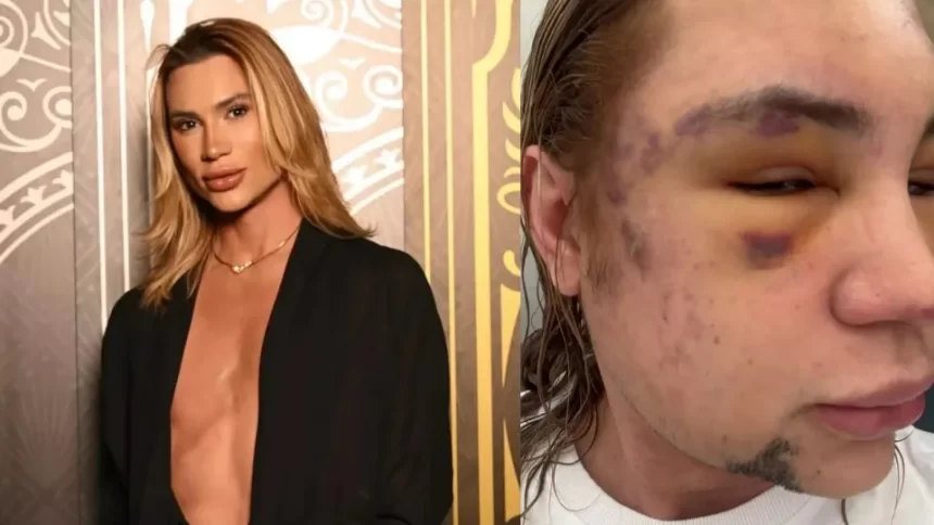 influenciador-junior-dutra-morre-apos-procedimento-estetico-malsucedido