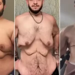 antes-e-depois:-influencer-perde-150-kg-e-retira-7-kg-de-excesso-de-pele