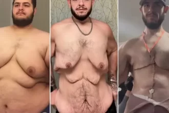 antes-e-depois:-influencer-perde-150-kg-e-retira-7-kg-de-excesso-de-pele