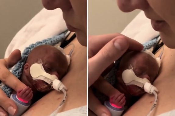 mulher-abraca-seu-bebe-prematuro-em-‘despedida’,-mas-acaba-surpreendida-pelo-desfecho