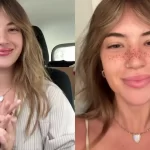influencer-viraliza-ao-tatuar-sardas-no-rosto-e-rebate-criticas-na-web