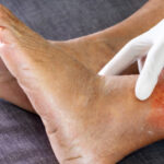 governo-do-tocantins-inaugura-ambulatorio-de-feridas-e-reabilitacao-tecidual-no-hospital-geral-de-palmas