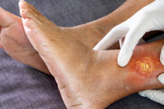 governo-do-tocantins-inaugura-ambulatorio-de-feridas-e-reabilitacao-tecidual-no-hospital-geral-de-palmas