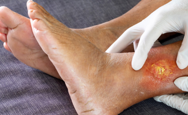 governo-do-tocantins-inaugura-ambulatorio-de-feridas-e-reabilitacao-tecidual-no-hospital-geral-de-palmas