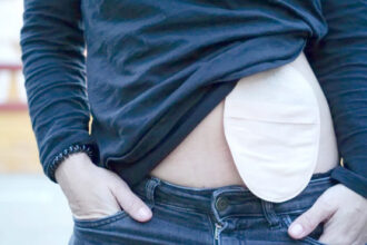 no-dia-nacional-dos-ostomizados,-ses-to-destaca-a-importancia-da-informacao-no-combate-ao-preconceito