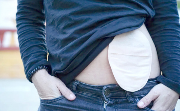 no-dia-nacional-dos-ostomizados,-ses-to-destaca-a-importancia-da-informacao-no-combate-ao-preconceito