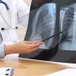 estado-de-sao-paulo-vive-boom-de-pneumonia-e-casos-quase-triplicam-em-tres-anos