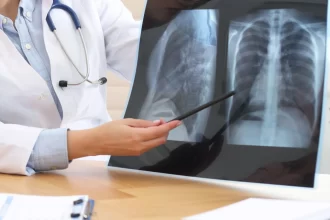 estado-de-sao-paulo-vive-boom-de-pneumonia-e-casos-quase-triplicam-em-tres-anos