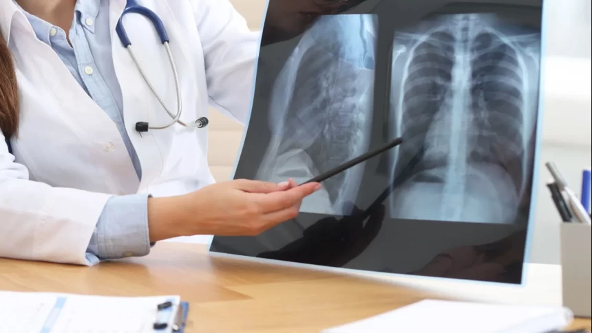 estado-de-sao-paulo-vive-boom-de-pneumonia-e-casos-quase-triplicam-em-tres-anos