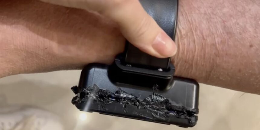 bolsonaro-diz-que-usou-ferro-de-solda-para-tentar-tirar-tornozeleira