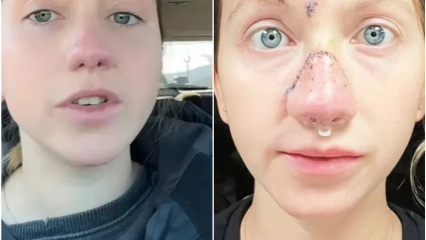 mulher-mostra-rosto-reconstruido-apos-ter-nariz-arrancado-por-cao-nos-eua