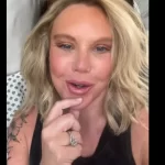 mulher-mostra-como-ficou-rosto-apos-lifting;-“prefiro-continuar-feia”