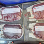 governo-do-tocantins-realiza-primeira-irradiacao-de-hemacias-e-amplia-seguranca-transfusional-para-pacientes