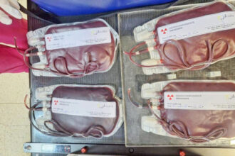 governo-do-tocantins-realiza-primeira-irradiacao-de-hemacias-e-amplia-seguranca-transfusional-para-pacientes