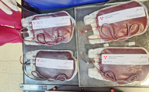 governo-do-tocantins-realiza-primeira-irradiacao-de-hemacias-e-amplia-seguranca-transfusional-para-pacientes