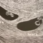 eua:-bilionario-chines-usa-barriga-de-aluguel-para-ter-mais-de-100-filhos