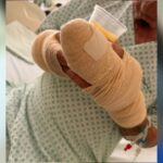 idoso-atacado-por-pitbull-em-palmas-vai-passar-pela-quarta-cirurgia-em-dez-dias,-diz-neta