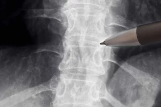 anvisa-libera-estudo-com-medicamento-para-lesoes-na-medula-espinhal