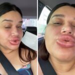 maquiadora-fica-com-labios-gigantes-apos-retirar-preenchimento-e-viraliza-ao-rir-da-situacao:-‘lindissima’