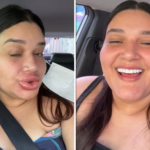 maquiadora-que-ficou-com-labios-gigantes-conta-que-preenchimento-deu-errado:-‘estavam-tortos’