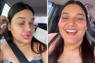 maquiadora-que-ficou-com-labios-gigantes-conta-que-preenchimento-deu-errado:-‘estavam-tortos’