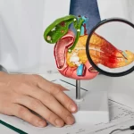 crescem-casos-de-cancer-de-pancreas-antes-dos-50-anos;-aumento-e-maior-entre-mulheres