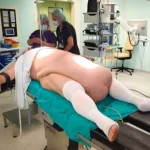 tumor-abdominal-de-35-kg-impede-homem-de-urinar-e-choca-medicos