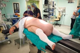 tumor-abdominal-de-35-kg-impede-homem-de-urinar-e-choca-medicos