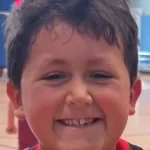 menino-faz-desafio-do-tiktok-e-acaba-com-rosto-desfigurado