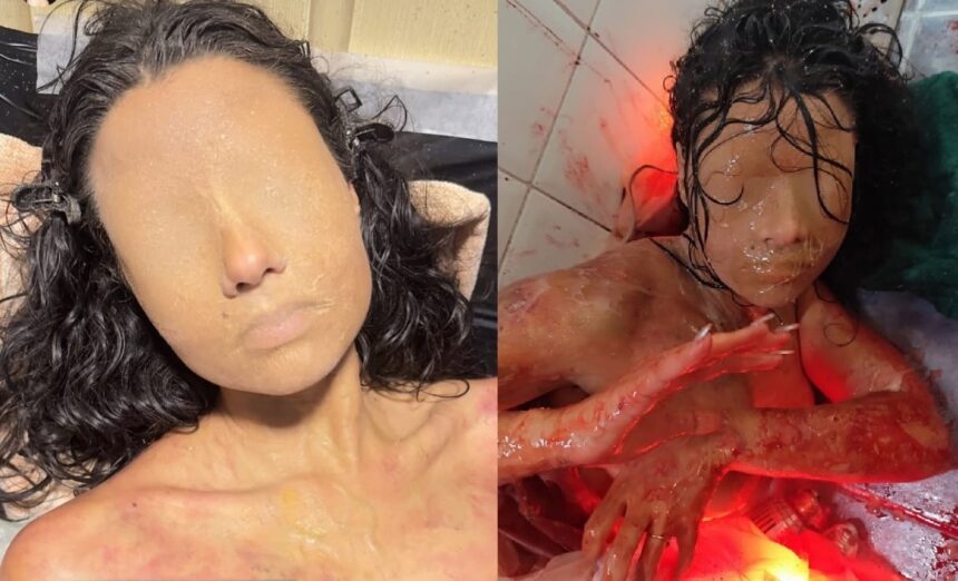 reconhece?-protagonista-de-novela-surge-‘sem-olhos-e-sem-boca’-em-bastidor-de-filme