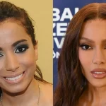 antes-e-depois-das-cirurgias-plasticas-dos-famosos:-os-procedimentos-que-eles-fizeram!