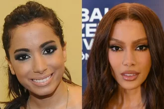 antes-e-depois-das-cirurgias-plasticas-dos-famosos:-os-procedimentos-que-eles-fizeram!