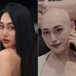 influenciadora-confunde-cancer-com-lesao-e-morre-aos-29-anos