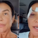 ivete-sangalo-passa-por-cirurgia-neste-domingo,-diz-portal